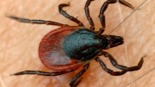 Zeckenaufnahme auf menschlicher Haut, mit rot-braunem Körper und schwarzem Kopf, scharf im Fokus.
